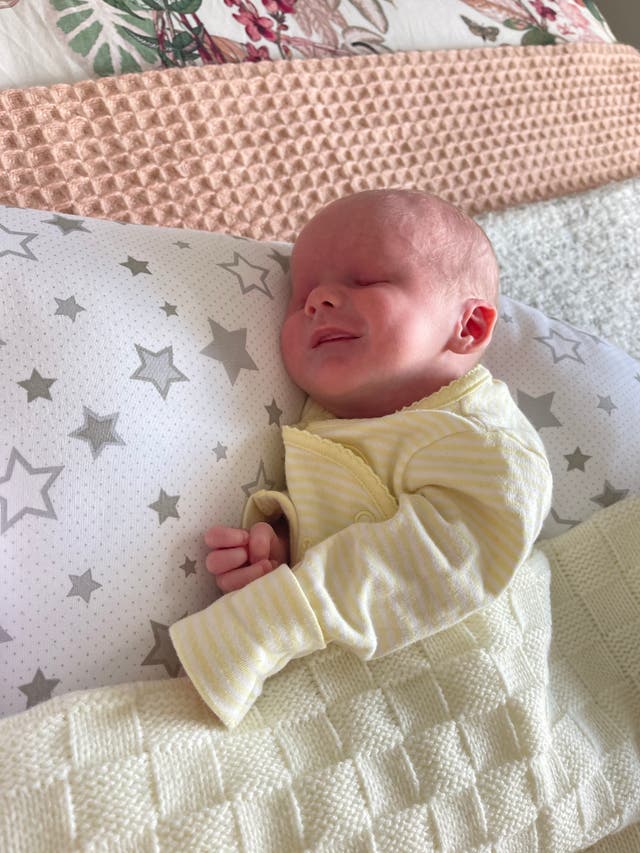 Bilateral Anophthalmia: Understanding The Rare Condition Of Babies Born Without Eyes Bilateral Anophthalmia: Understanding The Rare Condition Of Babies Born Without Eyes