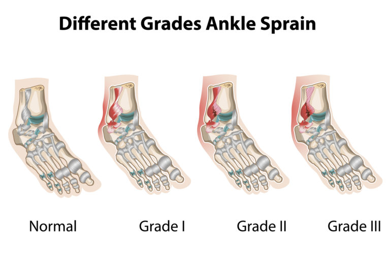 Brunson Expected Back Sunday: Ankle Sprain Recovery Update Brunson Expected Back Sunday: Ankle Sprain Recovery Update