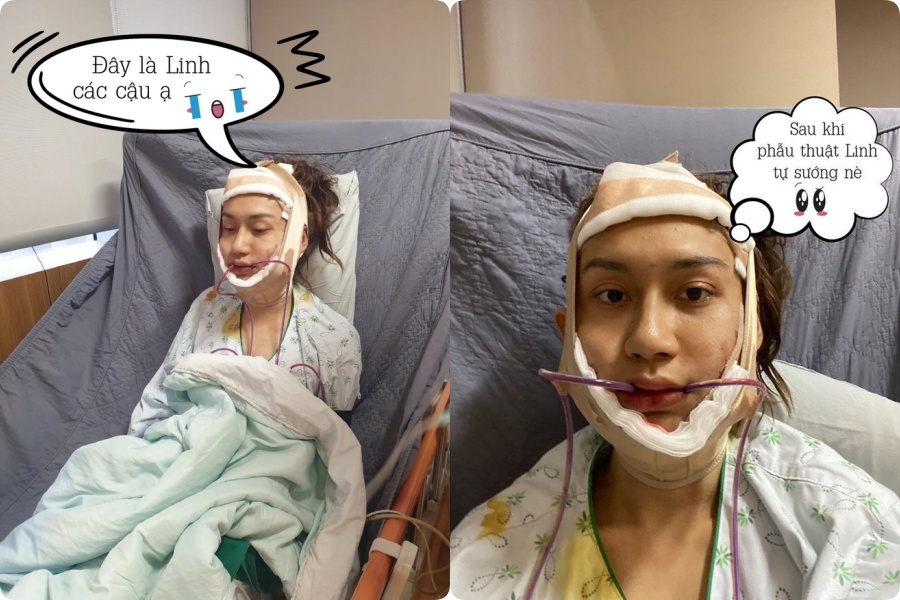 Cận Cảnh Nhan Sắc Thăng Hạng Của Lynk Lee Sau Chuyển Giới Cận Cảnh Nhan Sắc Thăng Hạng Của Lynk Lee Sau Chuyển Giới