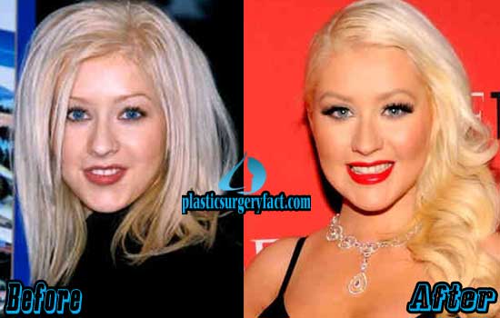 Christina Aguilera's Appearance: A Before & After Comparison Christina Aguilera's Appearance: A Before & After Comparison