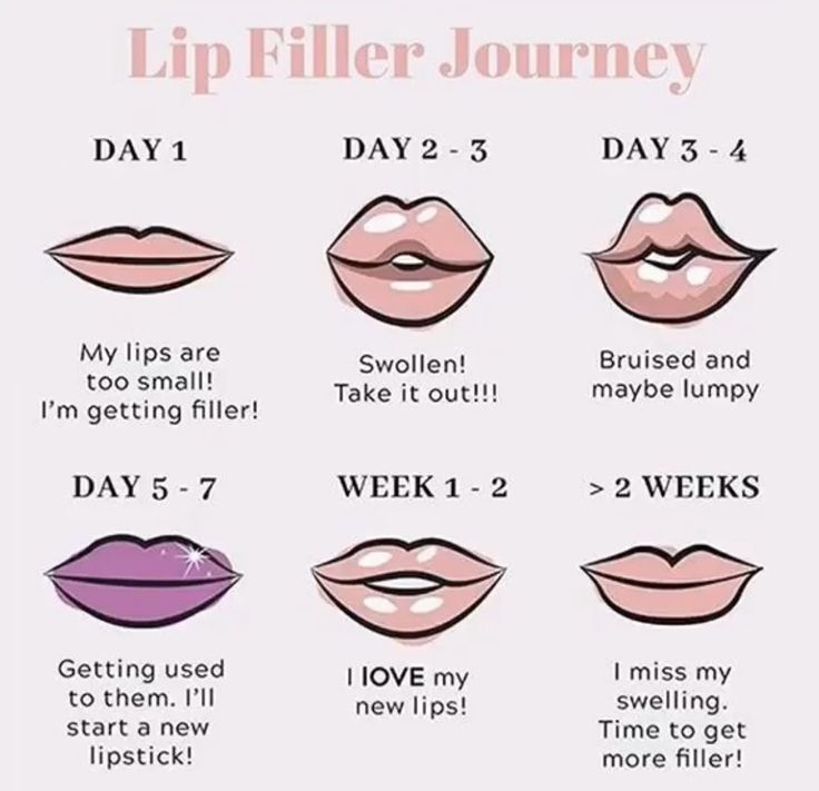 Daisy May Cooper's Weight Loss And Lip Filler Journey: An Honest Account Daisy May Cooper's Weight Loss And Lip Filler Journey: An Honest Account