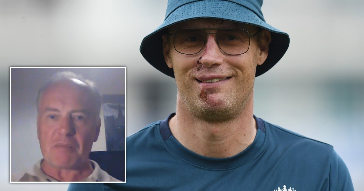 Freddie Flintoff On Life After His Serious Car Crash Freddie Flintoff On Life After His Serious Car Crash