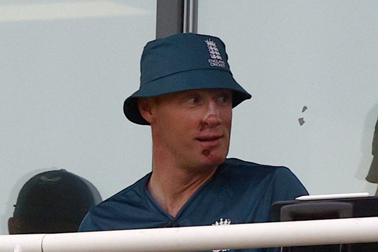 Freddie Flintoff's Life After His Horror Crash: PTSD, Recovery, And New Beginnings Freddie Flintoff's Life After His Horror Crash: PTSD, Recovery, And New Beginnings