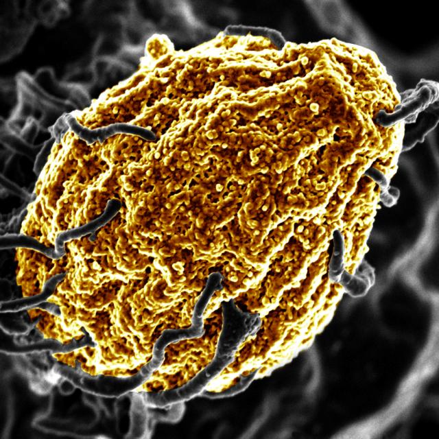 Investigating The Link Between Climate Change And Aggressive Fungi