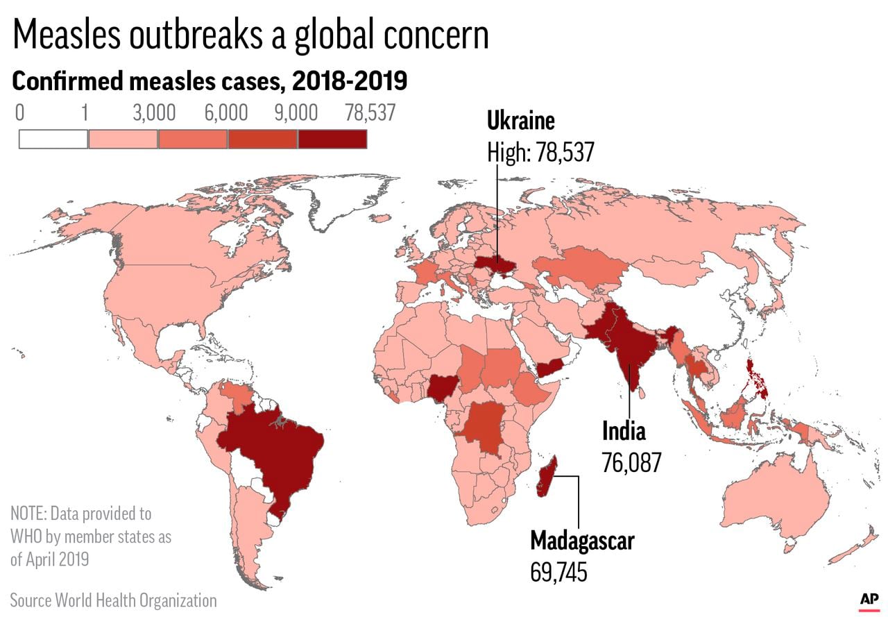 Measles Outbreak In The U.S.: A State-by-State Analysis Measles Outbreak In The U.S.: A State-by-State Analysis
