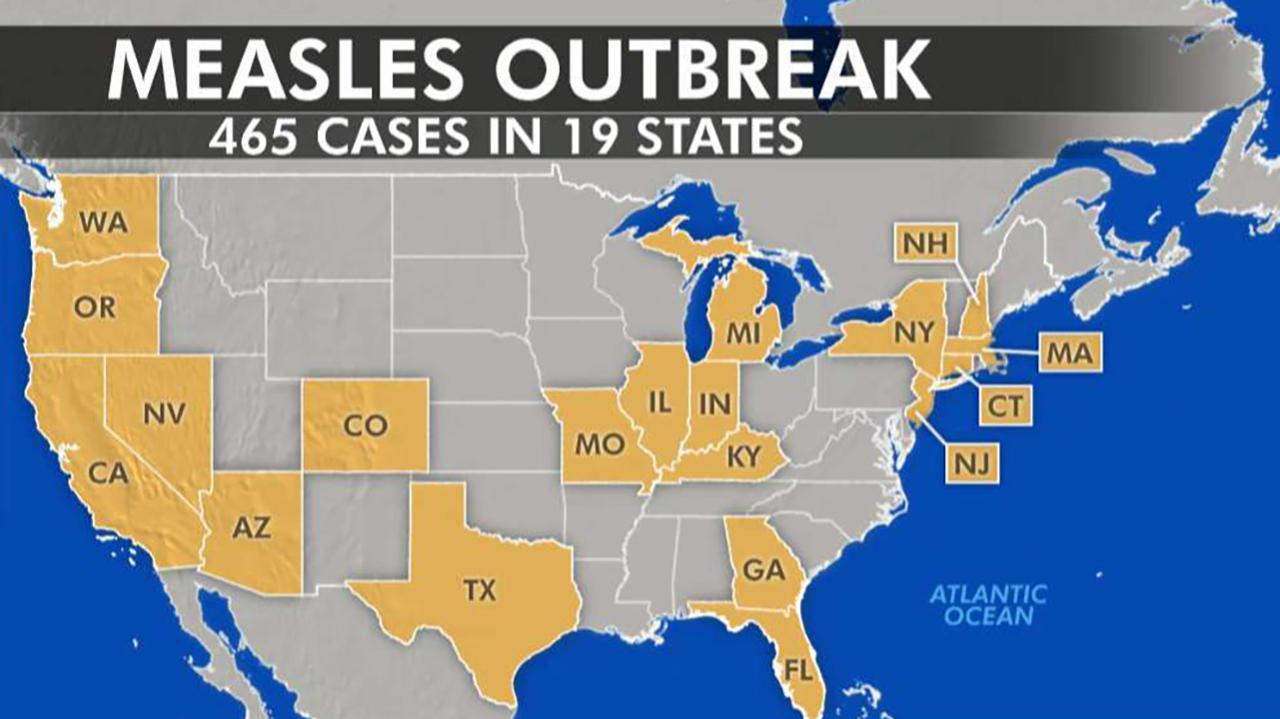Measles Outbreak Prompts US Vaccine Monitoring Initiative Measles Outbreak Prompts US Vaccine Monitoring Initiative