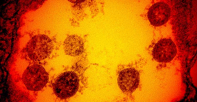 New COVID-19 Variant: A Concerning Uptick In Cases, Says WHO New COVID-19 Variant: A Concerning Uptick In Cases, Says WHO