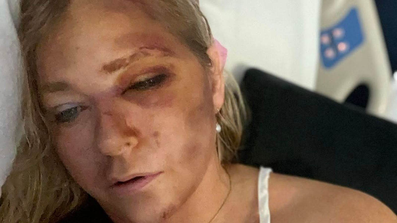 Prince Andrew Accuser Virginia Giuffre In Car Accident: Claims She Has Four Days Left Prince Andrew Accuser Virginia Giuffre In Car Accident: Claims She Has Four Days Left
