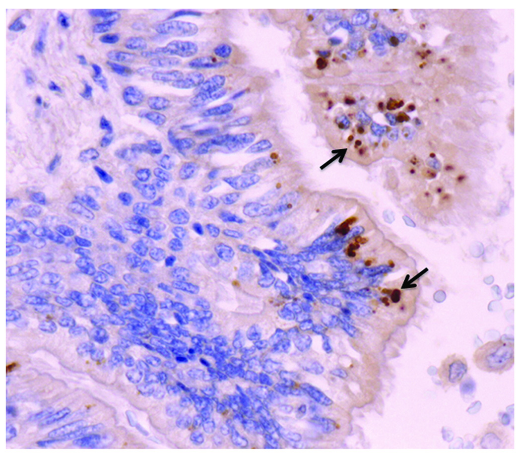 Research Links Kawasaki Disease To A Previously Unknown Respiratory Virus Research Links Kawasaki Disease To A Previously Unknown Respiratory Virus