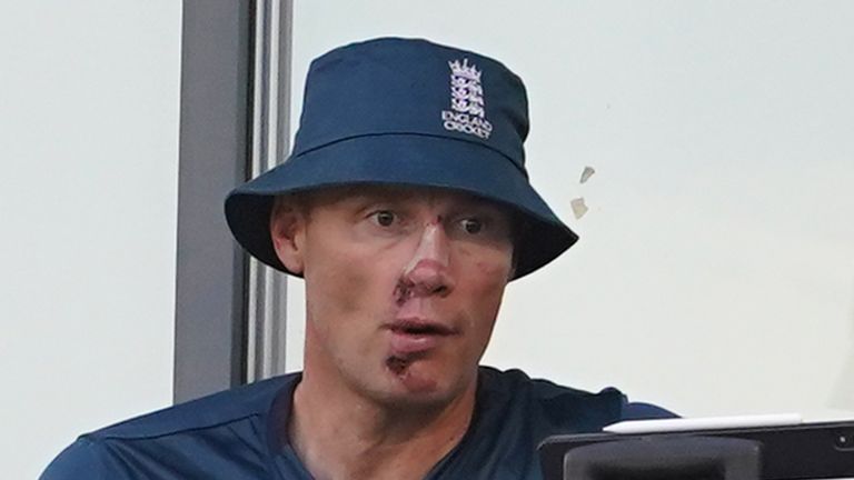 The Aftermath: Freddie Flintoff Speaks On His Horrific Crash The Aftermath: Freddie Flintoff Speaks On His Horrific Crash