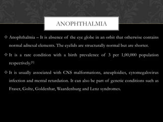The Rare Condition Of Bilateral Anophthalmia: Medical Advancements And Future Outlook The Rare Condition Of Bilateral Anophthalmia: Medical Advancements And Future Outlook