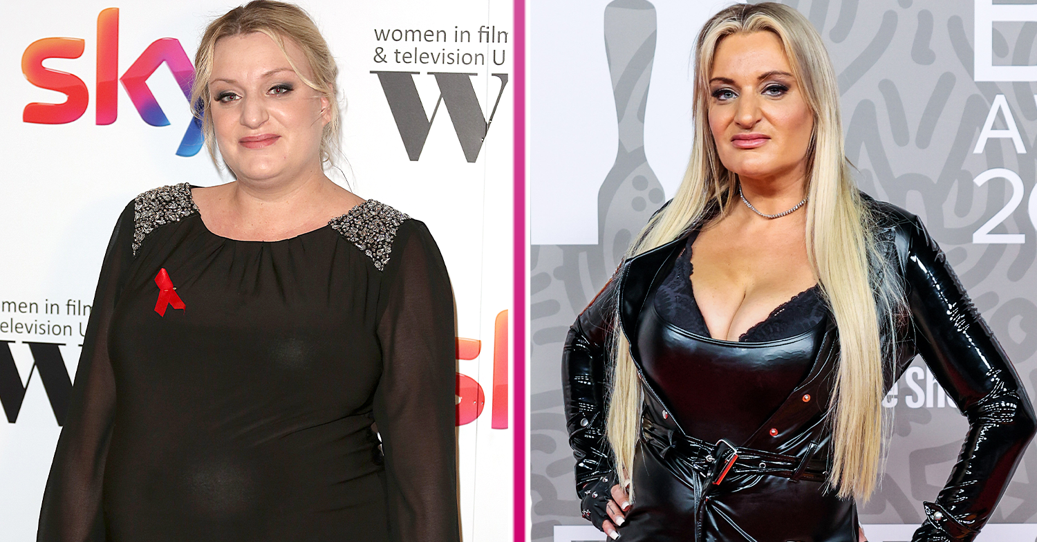 The Real Story Behind Daisy May Cooper's Transformation: Weight And Fillers The Real Story Behind Daisy May Cooper's Transformation: Weight And Fillers