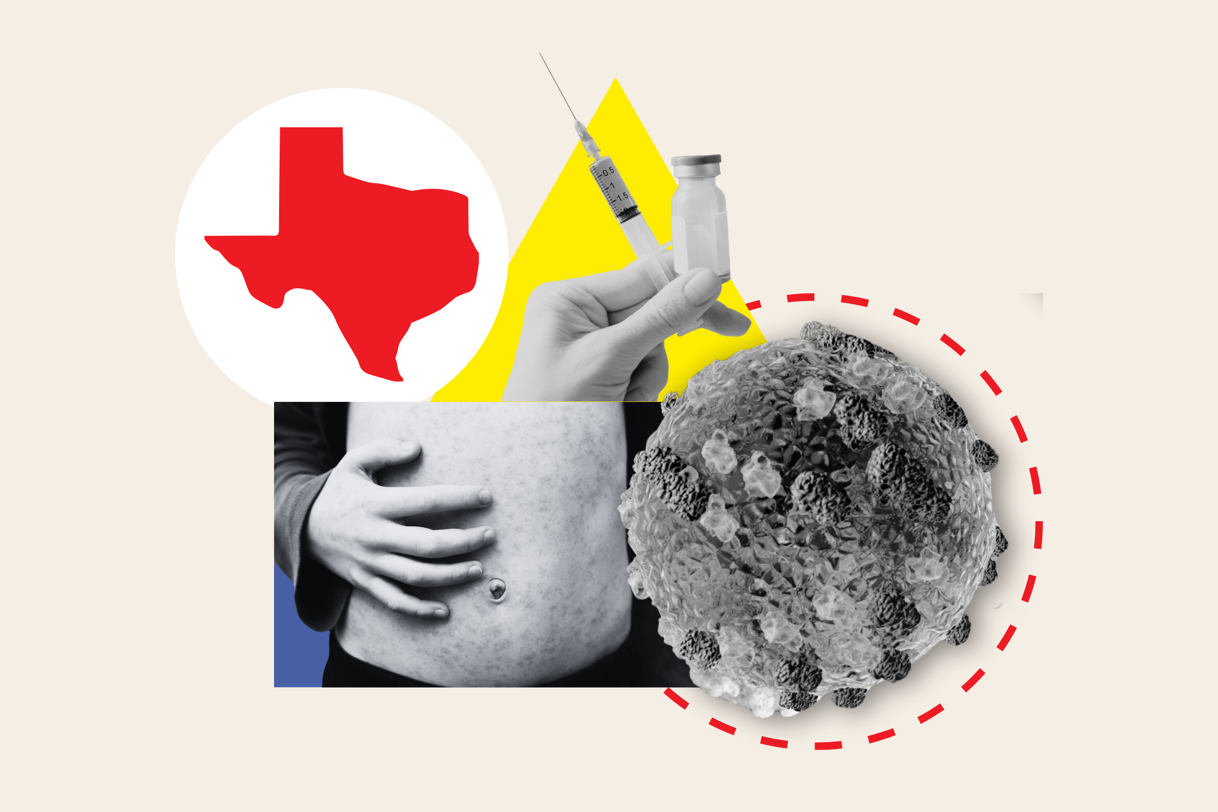 The Return Of Measles: Examining The Kansas Outbreak The Return Of Measles: Examining The Kansas Outbreak