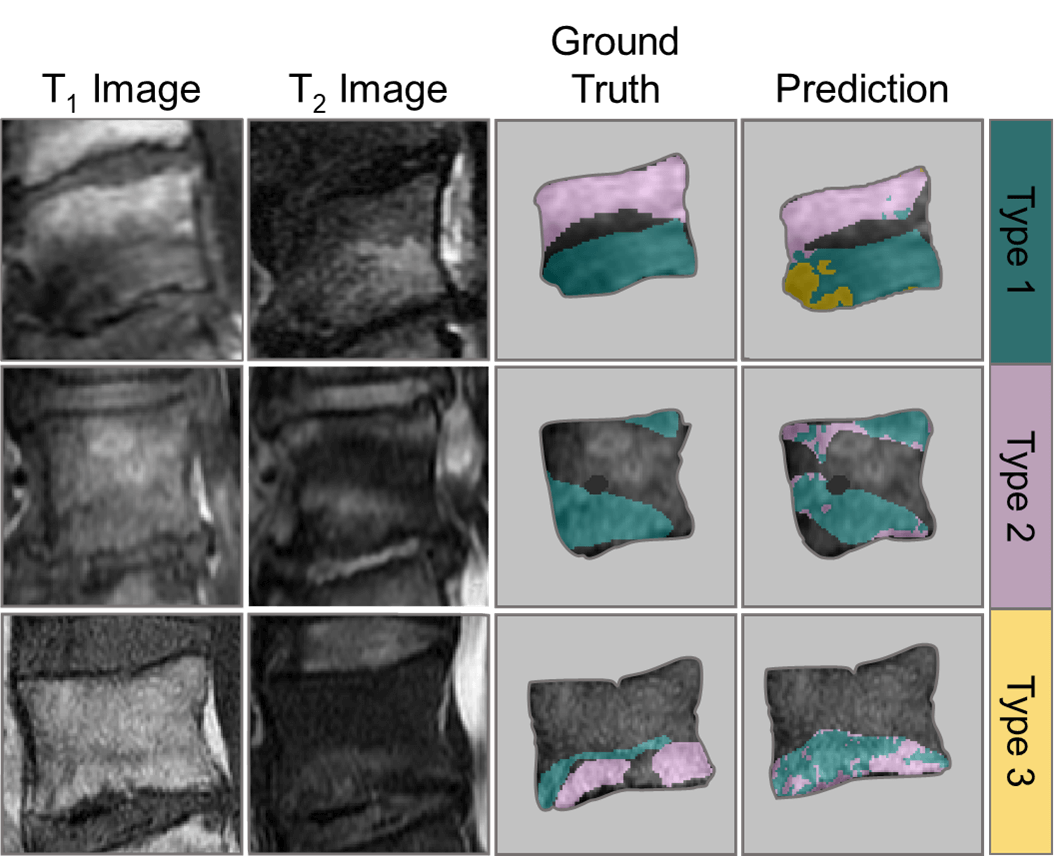 Using AI To Analyze And Transform Repetitive Scatological Data Into A Podcast Using AI To Analyze And Transform Repetitive Scatological Data Into A Podcast