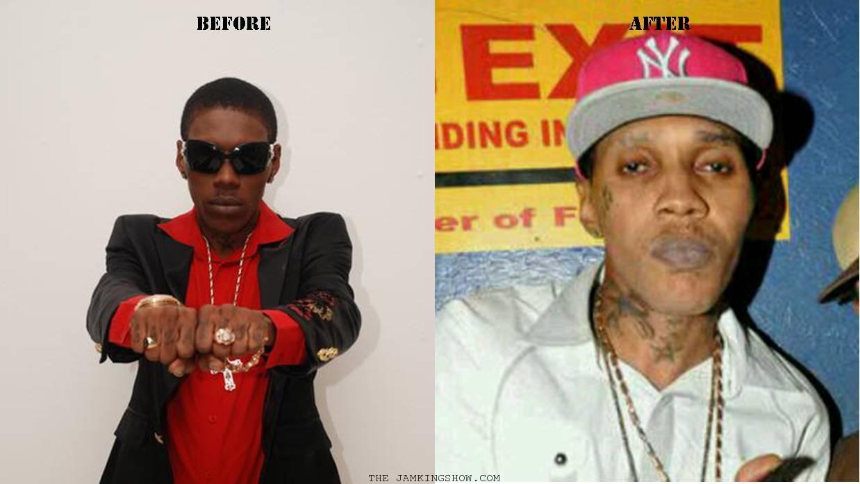 Vybz Kartel: Self-Esteem Issues And Skin Bleaching Vybz Kartel: Self-Esteem Issues And Skin Bleaching